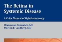 The Retina in Systemic Disease: A Color Manual of Ophthalmoscopy 1st Edition (2009) by Homayoun Tabandeh PDF