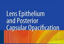 Lens Epithelium and Posterior Capsular Opacification 2014th Edition (2014) by Shizuya Saika PDF