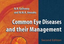 Common Eye Diseases and their Management 2nd Edition (2013) by Nicholas Robert Galloway PDF
