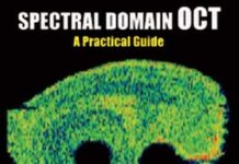 Spectral Domain Oct: A Practical Guide 2nd Edition (2011) by Shaun Dacosta PDF