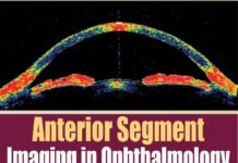 Anterior Segment Imaging in Ophthalmology with DVD-ROM (2008) by Tanuj Dada PDF