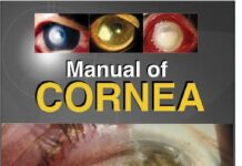Manual of Cornea 1st Edition (2008) by A. Samuel Gnanadoss PDF