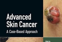 Advanced Skin Cancer: A Case-Based Approach 1st Edition (2022) by Debjani Sahni PDF