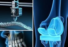 Biomedical Implants 1st Edition (2024) by Ravi K. Dwivedi PDF