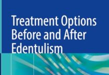 Treatment Options Before and After Edentulism: Implant Overdenture (2024) by Yasemin Kulak Özkan PDF