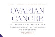 Ovarian Cancer: The Gynaecological Challenge from Diagnostic Work-up to Cytoreduction and Chemotherapy (1) 1st Edition (2023) by Christos Iavazzo PDF