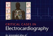 Critical Cases in Electrocardiography: An Annotated Atlas of Don’t-Miss ECGs for Emergency Medicine and Critical Care 1st Edition (2018) by Steven R. Lowenstein PDF