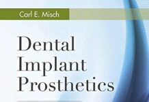 Dental Implant Prosthetics – E-Book 2nd Edition (2014) by Carl E. Misch PDF