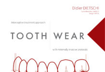 Tooth Wear – Interceptive treatment approach with minimally invasive protocols (2023) Didier DIETSCHI