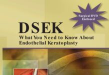 DSEK – What You Need to Know About Endothelial Keratoplasty (2014) Multiple Authors