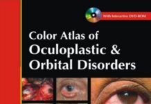 Color Atlas of Oculoplastic and Orbital Disorders (2009) Arnab Biswas