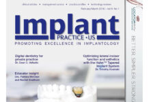 Implant Practice US – PROMOTING EXCELLENCE IN IMPLANTOLOGY (2016) Steve Barter