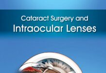 Cataract surgery and intraocular lenses (2014) Lucio Buratto