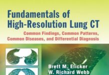 Fundamentals of high-resolution lung CT – common findings, common patterns, common diseases, and differential diagnosis (2013) Brett M. Elicker