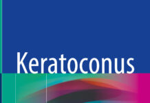 Keratoconus – A Comprehensive Guide to Diagnosis and Treatment (2022) Edna Almodin