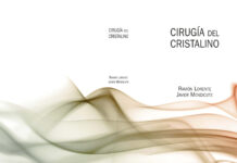 Cirugía del cristalino – LXXXIV Ponencia Oficial de la Sociedad Española de Oftalmología (2008) Ramón Lorente