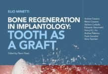 Bone Regeneration in Implantology – Tooth as a Graft (2021) Elio Minetti