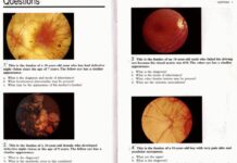 Kanski’s Picture Tests in Ophthalmology – Self-Assessment and Review of Ocular Pathology and Clinical Cases (2005) Jack J. Kanski