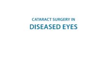 Cataract Surgery in Diseased Eyes (2014) Arup Chakrabarti