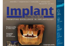 Implant PRACTICE US – PROMOTING EXCELLENCE IN IMPLANTOLOGY (2014) Steve Barter