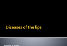 Diseases and Differential Diagnosis of the Lips – Clinical Notes and Syndromes of the Oral Mucosa (2024) Haitham M. Saleh