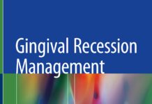 Gingival Recession Management – A Clinical Manual (2018) Adrian Kasaj