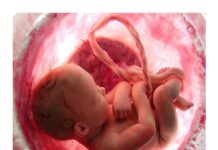 Obstetrics – Comprehensive Clinical Notes and Guidelines (2024) MedSN