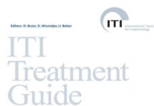 ITI Treatment Guide – Implant Placement in Post Extraction Sites Treatment Options (2008) S. Chen