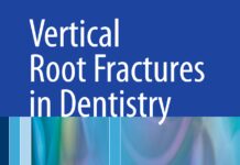 Vertical Root Fractures in Dentistry (2015) Aviad Tamse