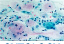 Cytology – Diagnostic Principles and Clinical Correlates (2021) Edmund S. Cibas, MD