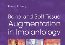 Bone and Soft Tissue Augmentation in Implantology (2022) Fouad Khoury