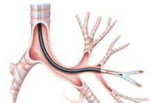 Pediatric Bronchoscopy for Clinicians (2023) Don Hayes, Jr., MD, MS, MEd