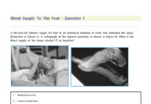 OrthoBullets MCQs – Foot & Ankle Multiple Choice Questions (2025) Moaz Zaky