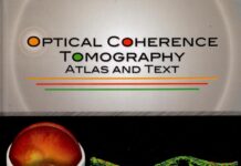 Optical Coherence Tomography – Atlas and Text (2009) Samuel Boyd, MD