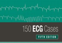 150 ECG Cases (2019) John Hampton