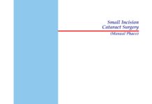 Small Incision Cataract Surgery – (Manual Phaco) (2002) Kamaljeet Singh