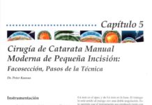 Cirugía de Catarata Manual Moderna de Pequeña Incisión – Facosección, Pasos de la Técnica (2015) Dr. Peter Kansas