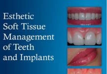Endodontic Techniques – A Comprehensive Guide to Root Canal Therapy (2012) Bettina Basrani