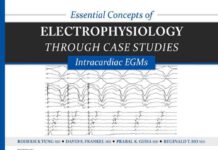 Essential Concepts of Electrophysiology Through Case Studies – Intracardiac EGMS (2015) Kenneth A. Ellenbogen