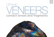 Ceramic VENEERS – contact lenses and fragments (2018) Paula de Carvalho Cardoso