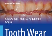 Tooth Wear – An Authoritative Reference for Dental Professionals and Students (2022) Andrew Eder