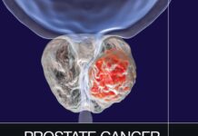 Prostate Cancer Imaging – An Engineering and Clinical Perspective (2019) Ayman El-Baz