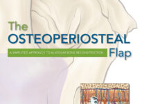 The Osteoperiosteal Flap – A Simplified Approach to Alveolar Bone Reconstruction (2009) Ole T. Jensen
