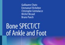 Bone SPECTCT of Ankle and Foot (2018) Guillaume Chuto