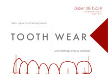 TOOTH WEAR – Interceptive treatment approach with minimally invasive protocols (2023) Didier DIETSCHI