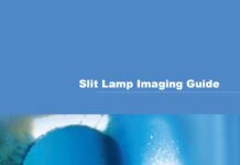 Slit Lamp Imaging Guide – BX 900® Photo Slit Lamp (2018) Csaba L. Mártonyi