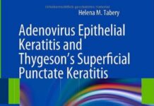 Adenovirus Epithelial Keratitis and Thygeson’s Superficial Punctate Keratitis – In Vivo Morphology in the Human Cornea (2012) Helena M. Tabery