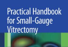 Practical Handbook for Small-Gauge Vitrectomy – A Step-By-Step Introduction to Surgical Techniques (2012) Ulrich Spandau