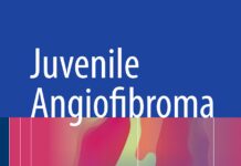 Juvenile Angiofibroma (2017) Siba P. Dubey