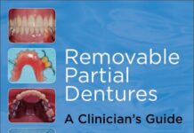 Removable Partial Dentures – A Clinician’s Guide (2009) John D. Jones